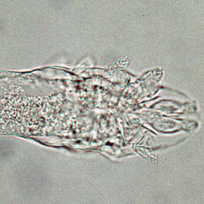 Sự thật về nỗi khiếp sợ “ghẻ Demodex”